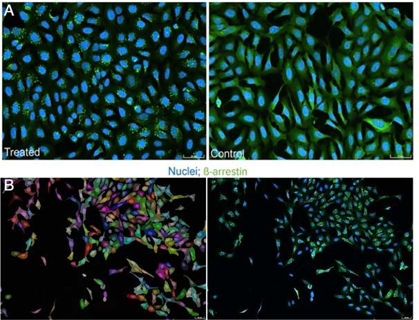 GPCR assay evaluation showing activated cells with β-arrestin punctae (green) and negative control