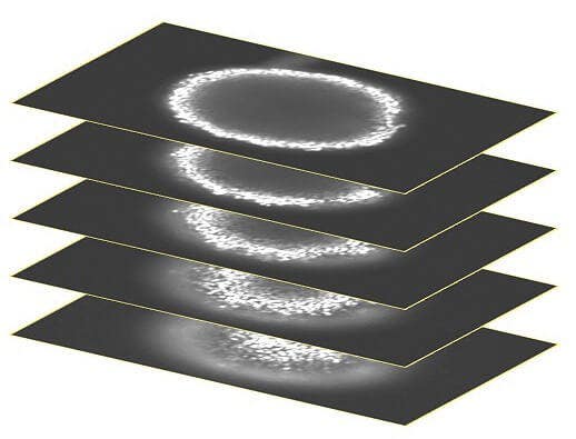 A stack of confocal images was acquired in the z plane