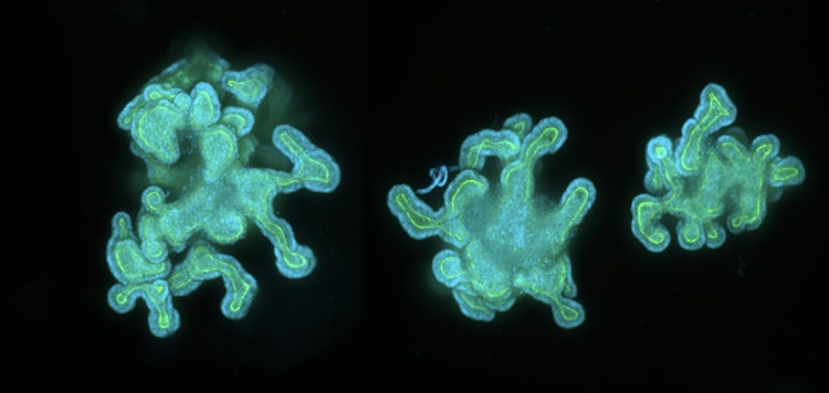 Intestinal organoids