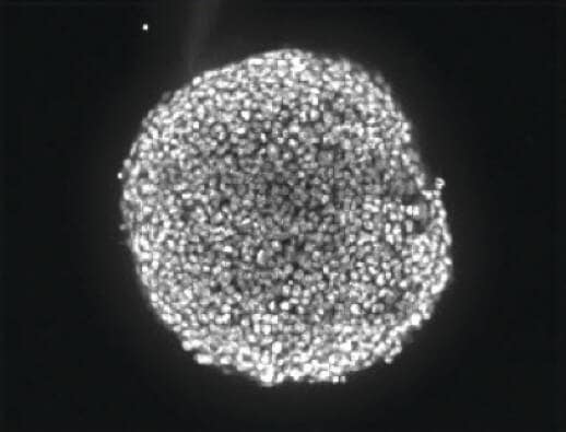 2D image to combine the in-focus areas