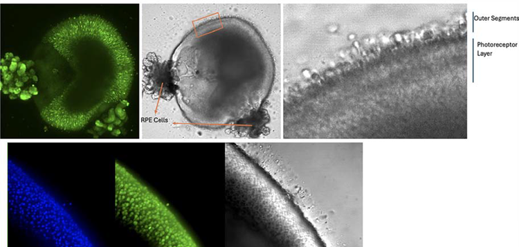 Separate images of a retinal organoid using different staining techniques
