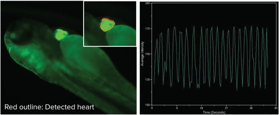 Cardiac function in transgenic zebrafish with cells expressing a GFP-tagged protein in the heart