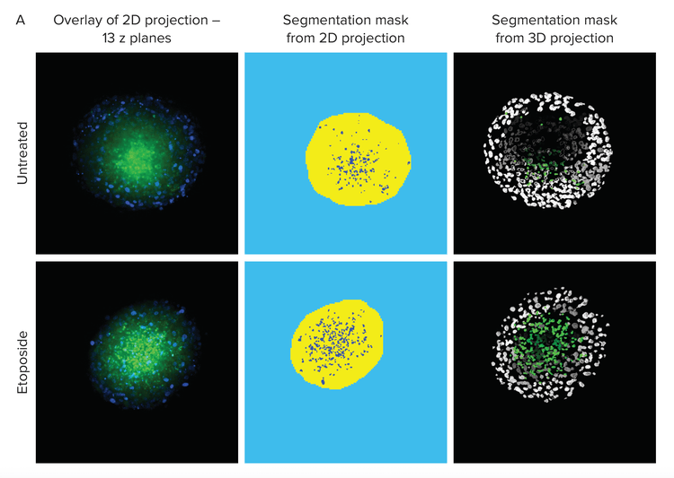 Comparison of 2D and 3D analysis