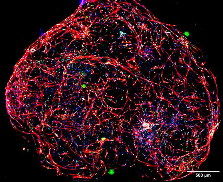 Graph showing number of neurites per well vs number of cell bodies per organoid