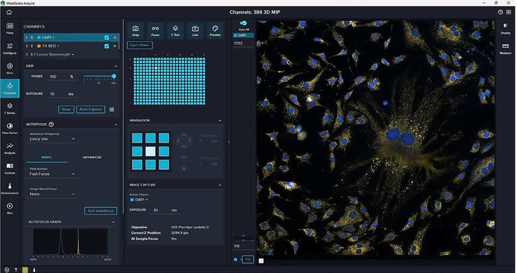Redesigned MetaXpress software offering flexible and customizable high-content imaging