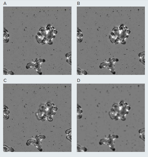 Transmitted light image of intestinal organoid with 2D projection