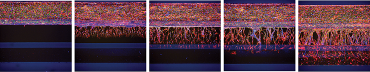 Angiogenic sprouting in OrganoPlate 3-lane