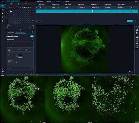 IN Carta Flexi-Protocol 2D interface for soma and neurite segmentation and B–C. Segmentation of synchronous brain organoid at different time points