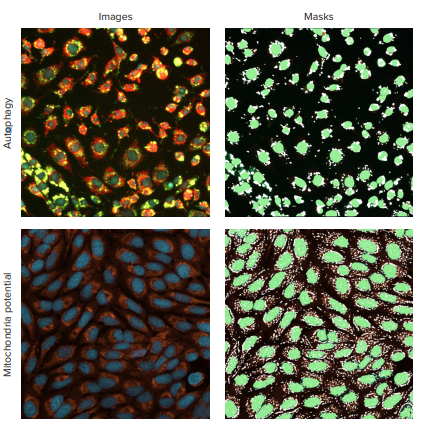 detection-of-autophagosomes