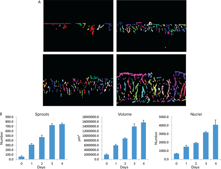 Quantitative assessment of angiogenesis