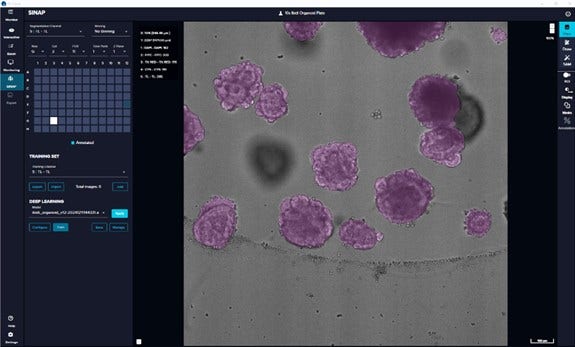 IN Carta Image Analysis Software modules: SINAP image segmentation module using training image sets, equipped with SAM