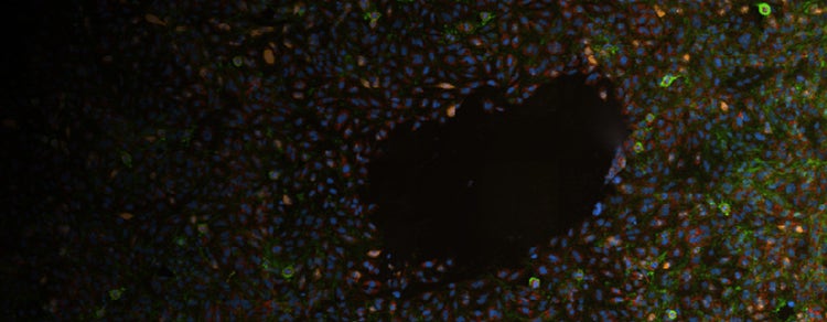 Single-molecule Spatial Transcriptomics