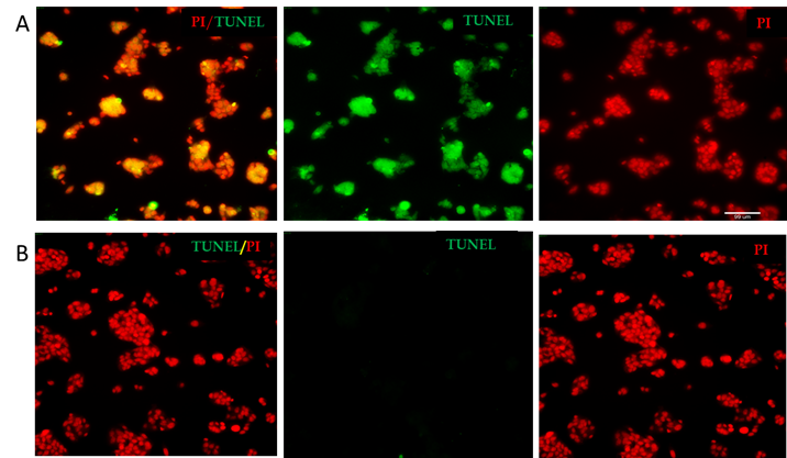 iPSC-derived Cardiomyocytes with TUNEL and Propidium Iodide