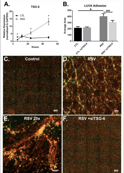 RSV-Infected Cells