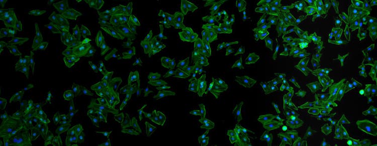 Cell Proliferation