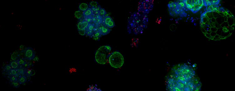 Image‑guided automated cell culture