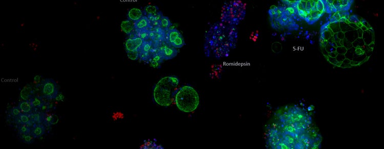 Organoids