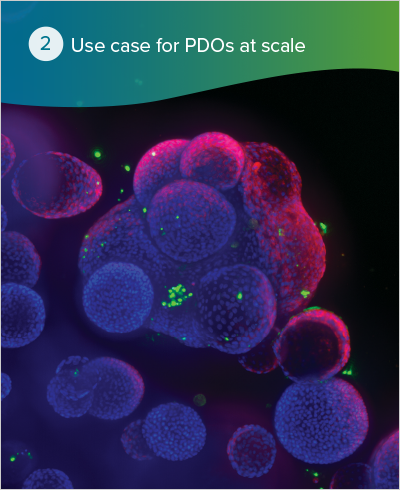 Organoid Use case for PDOs at scale