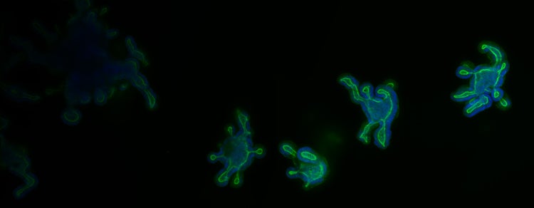 organoids