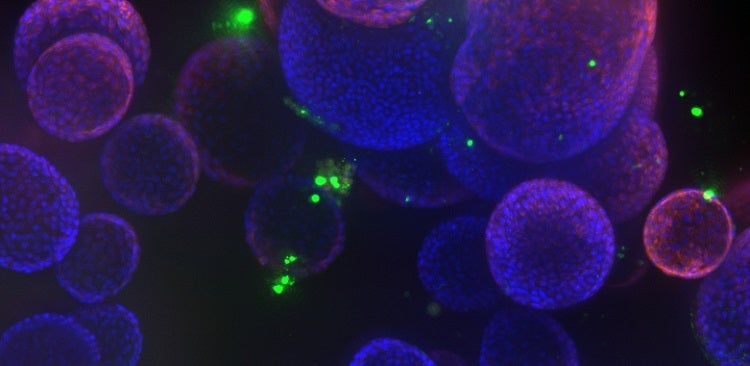 How automated organoid cell cultures are developed, imaged, and analyzed