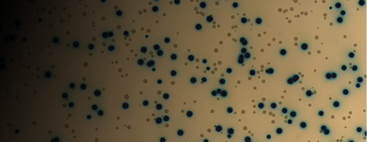 Microbial Screening