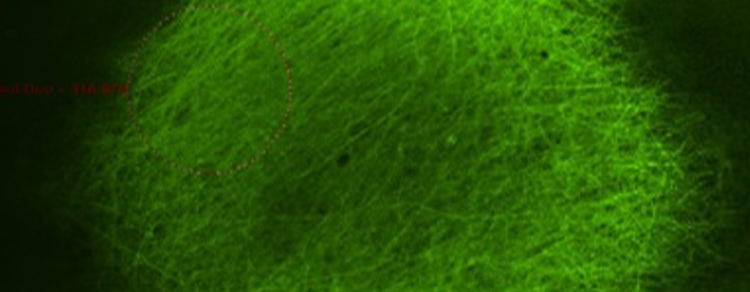 3D neural organoids