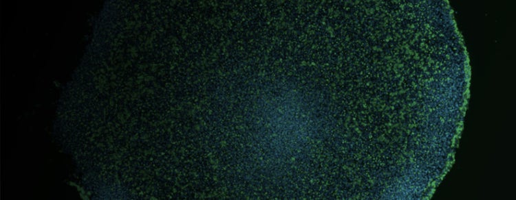 Brain Organoid Generation