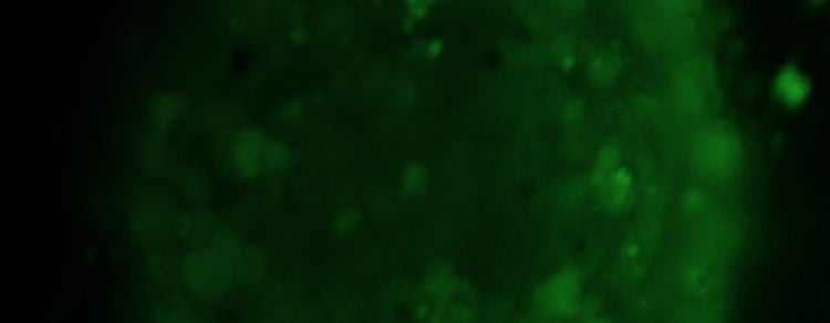 iPSC-derived 3D cardiac organoids