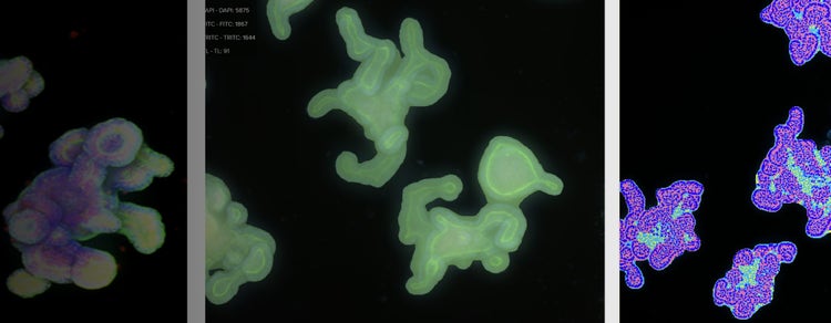 Intestinal 3D Organoids