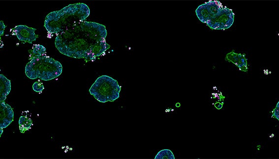 Scale Up Your Screening: Integrating Automation Into 3D Biology for Therapeutic Drug…