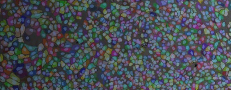 cell imaging using transmitted light