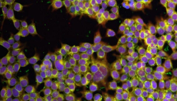 Increase Cell Painting assay throughput using an automated workstation