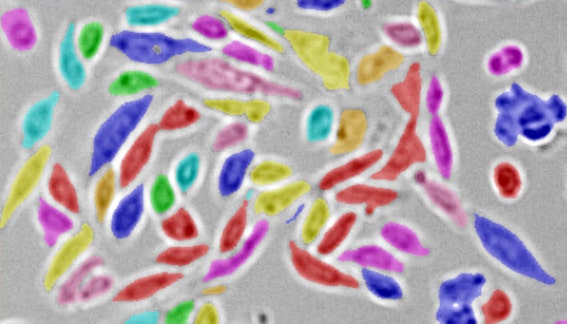 Label-free cell segmentation with IN Carta SINAP application module