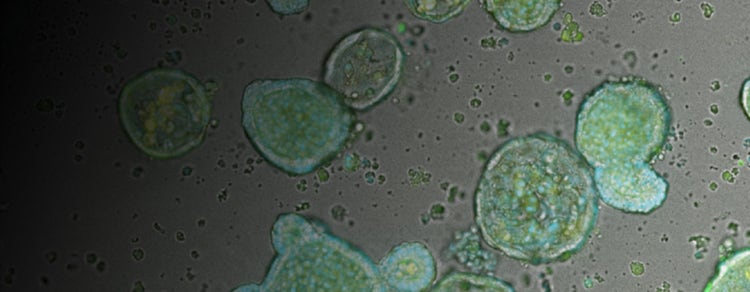 Intestinal Organoids