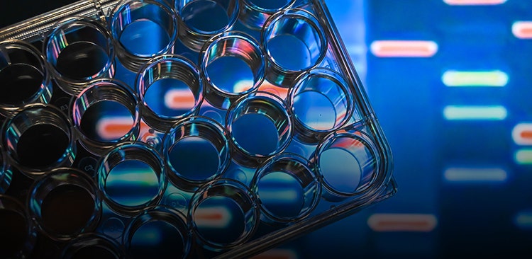 [Podcast] Challenges of traditional cell line development and emerging technologies to…