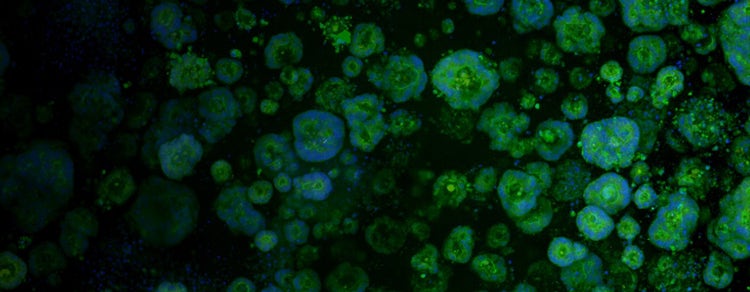 Integrated Patient-derived Organoid Workflow