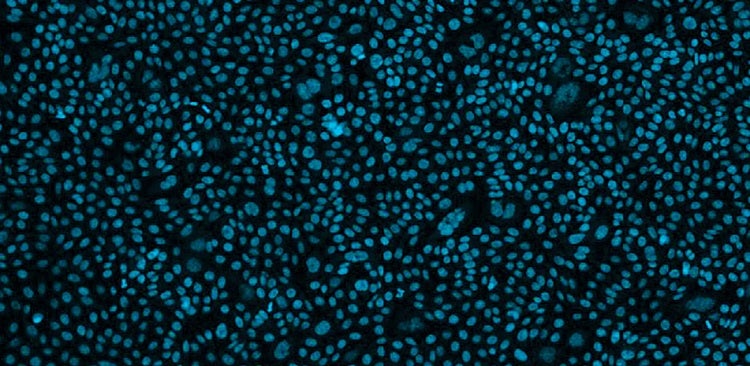 The evolution of CHO cells’ role in cell line development