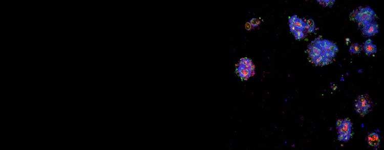 Patient-Derived Organoids