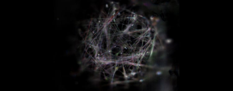 Brain Organoid Generation