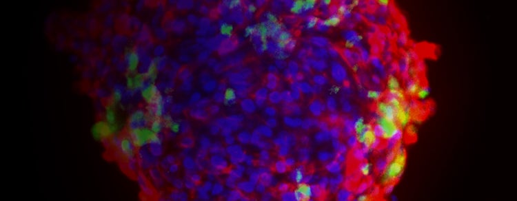 Cardiovascular Research