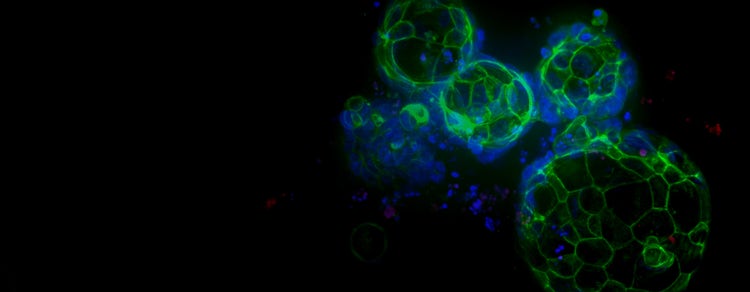 Organoid Research