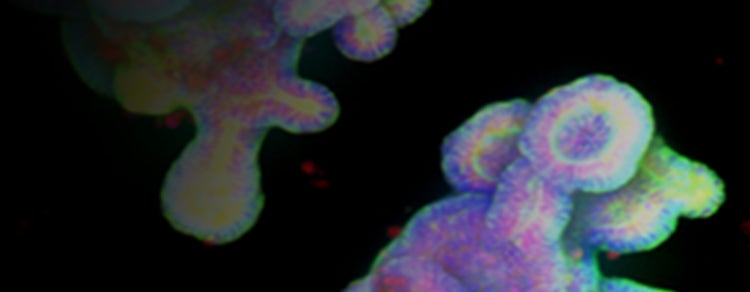 cardiac drug discovery