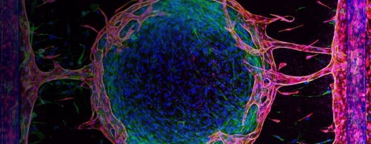 AgileOptix and high-content imaging
