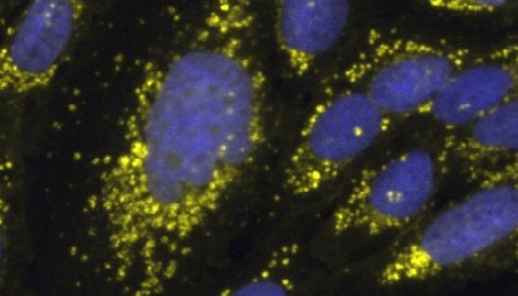 Improving the robustness of Cell Painting with a near-infrared label and advanced image…