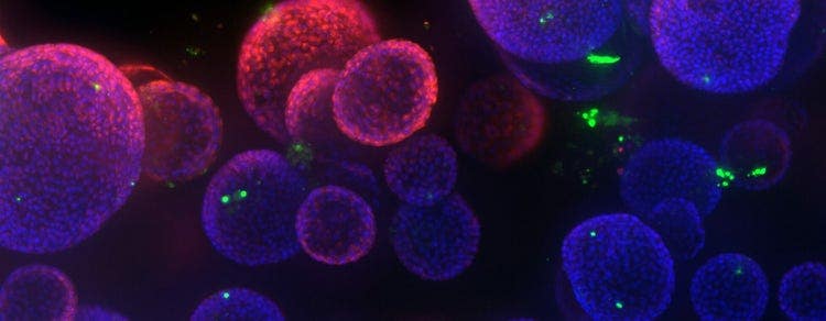 Organoid