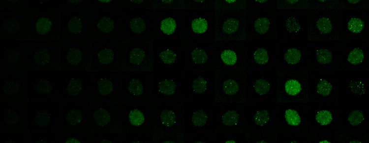 Disease Modeling