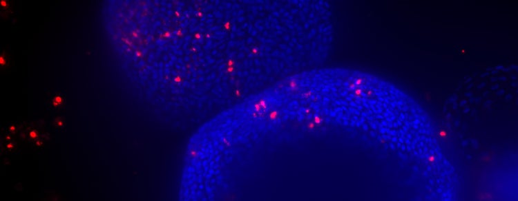 3D Organoids