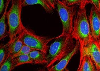 Cell Painting