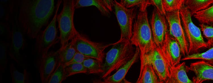 Cell Painting