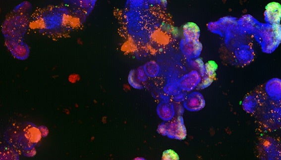 Monitoring growth and characterization of compound effects in 3D intestinal organoids by…